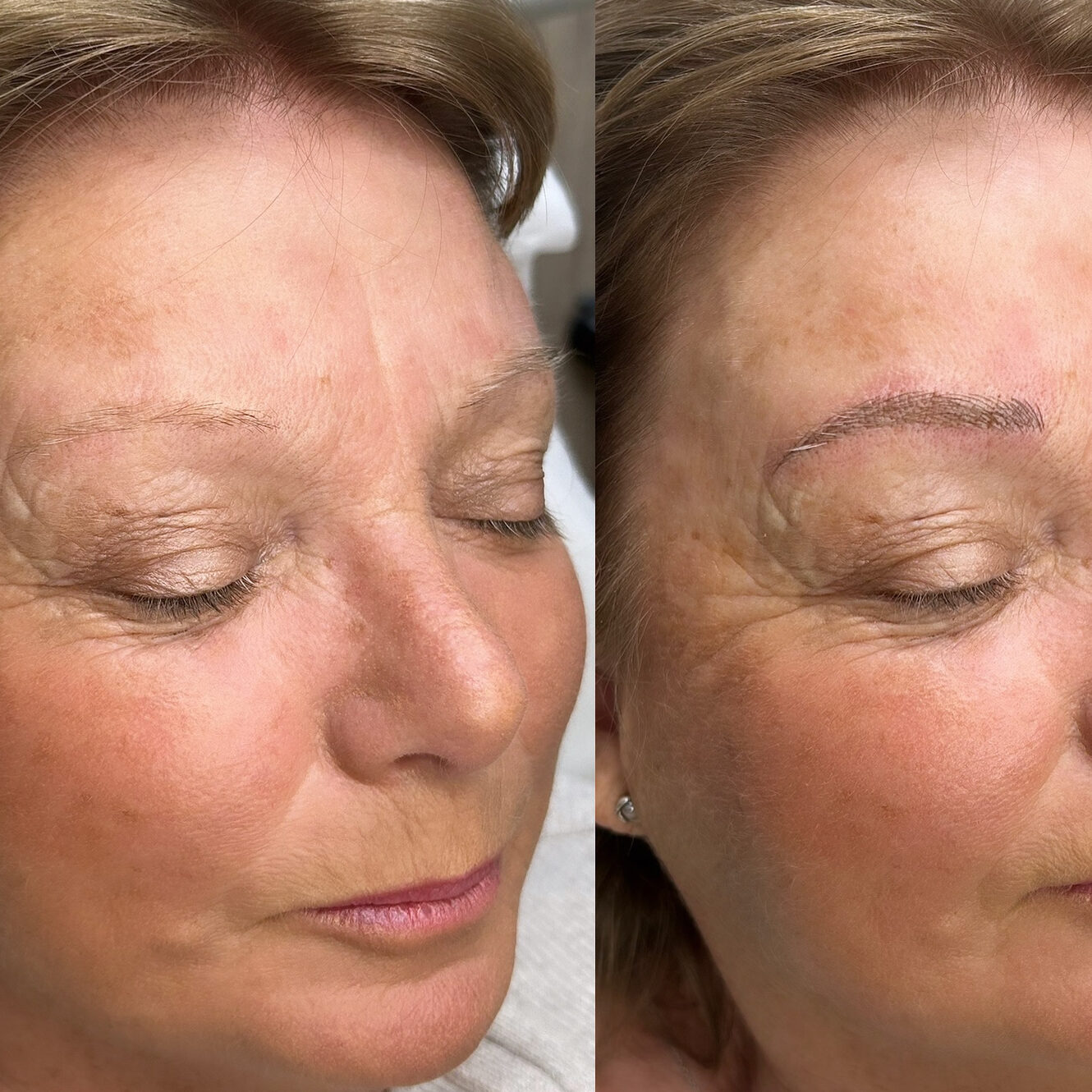 Before and After Microblading