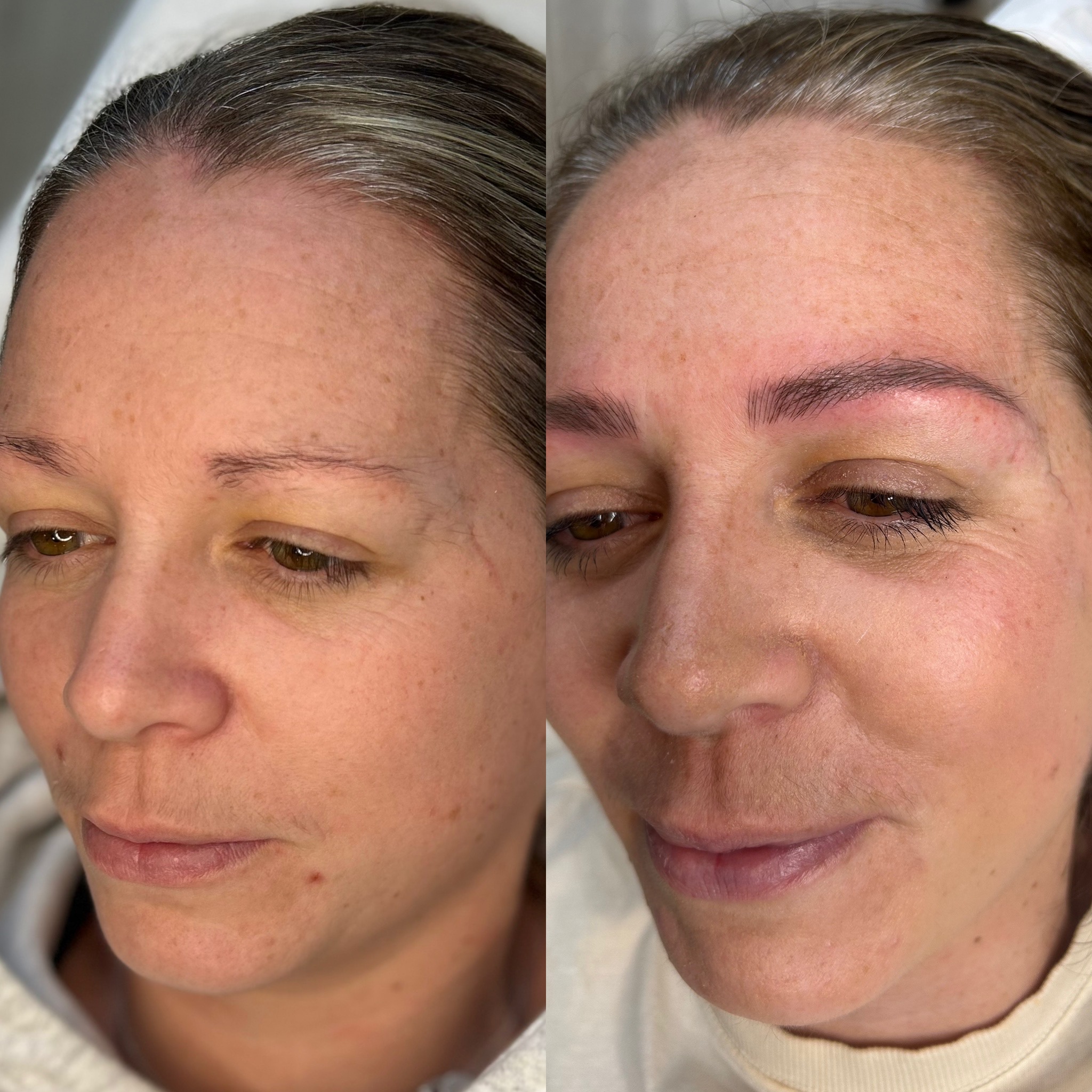 Before and After Microblading